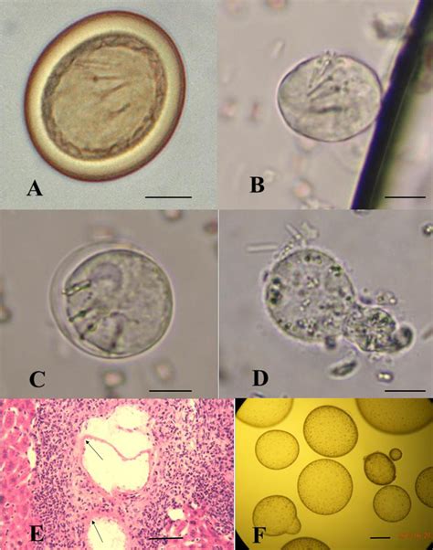 Echinococcus Granulosus Egg Morphology