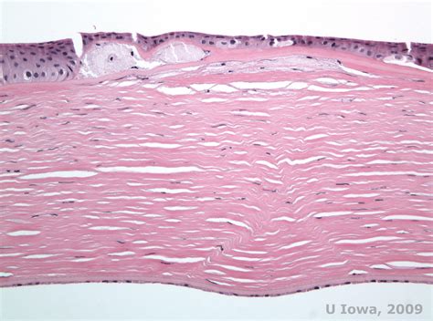 Corneal Stroma