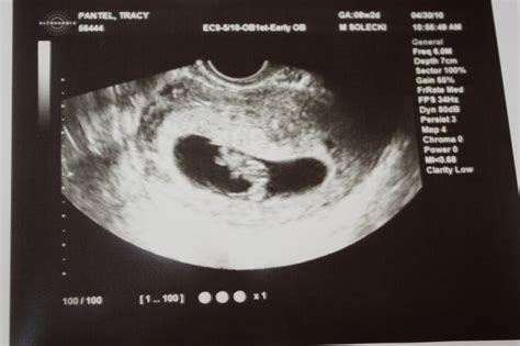 Pantel Family Blog: 8 week ultrasound