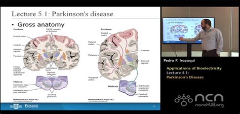 Applications of Bioelectricity - Parkinson's Disease - touchNEUROLOGY