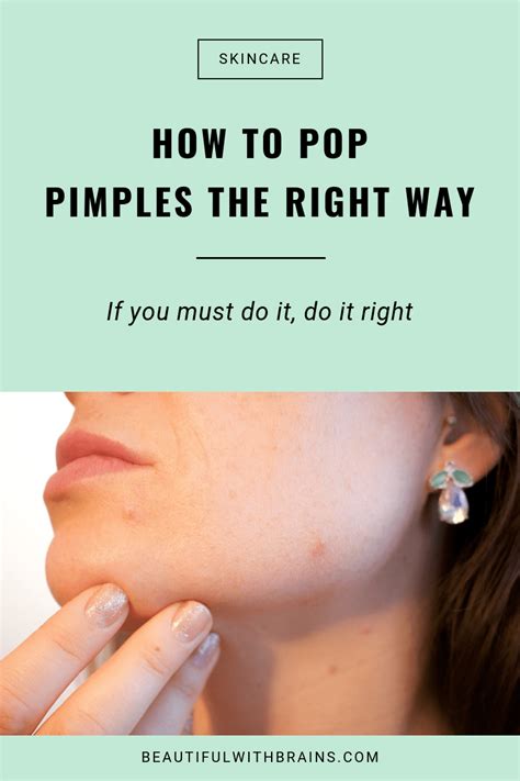 How To Pop A Pimple Like A Derm | Pimple popping, Pimples, Pop