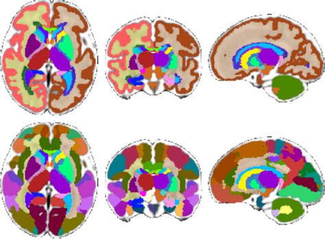 Fetal Brain Atlas