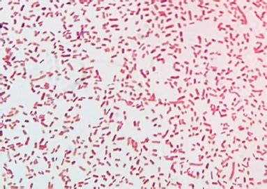 Klebsiella Pneumoniae Gram Stain