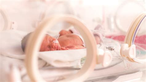 Premature Birth Complications: Short and Long-Term Health Effects