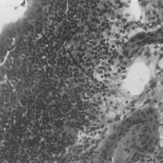 Control Group (Seven days) -Intense granulation reaction showing ...