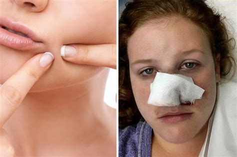 This woman’s pimple was the first sign of cancer – here’s what to look out for | Mens and Womens ...