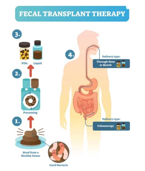 Fecal Transplantation: Science's Dirty Secret - Omixon