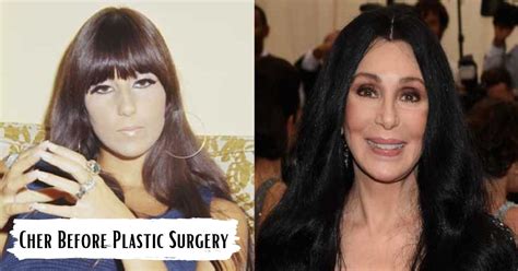 Cher Before Plastic Surgery, Flawless Face Has Changed Over Time