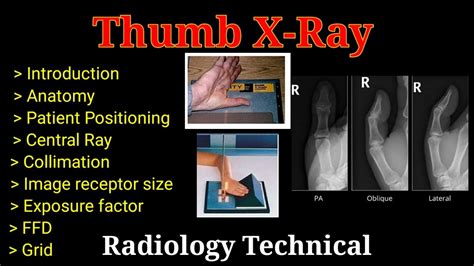 Thumb X-Ray # Thumb AP # Thumb Lateral # oblique view # Upper limb ...