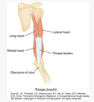 Distal Triceps Tendon Rupture Bishop | Total Wrist Arthroplasty Mammoth Lakes