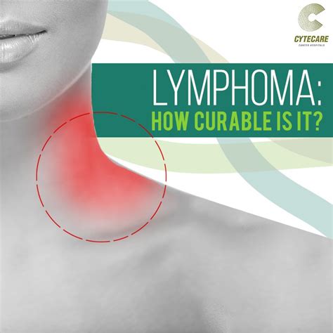 Is Lymphoma Curable? Lymphatic Cancer | Cytecare