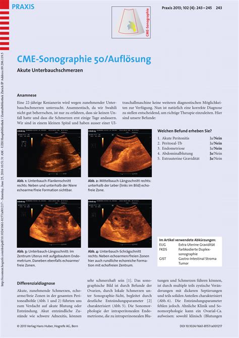 (PDF) [CME ultrasound diagnosis. Severe intraperitoneal hemorrhage in EUG (extrauterine pregnancy)]