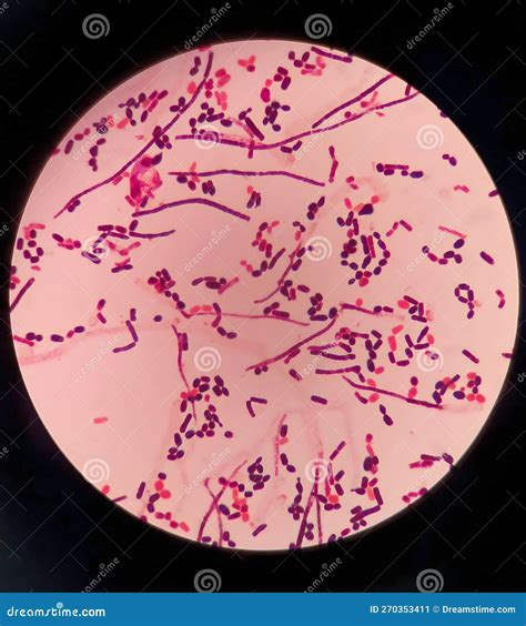 Yeast Cells and Hyphae in Gram Stain Fine with Microscope. Stock Image - Image of fever ...