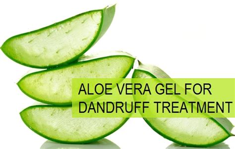 How to Use Aloe Vera Gel for Dandruff Treatment and Cure