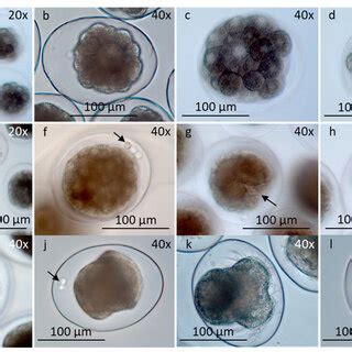 Early developed larvae in egg-strings and free-swimming veliger larvae ...