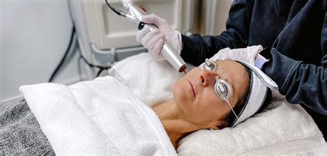 PicoWay Laser in Vancouver: Improve Acne Scars and Wrinkles