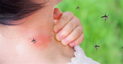 How Can I Prevent and Treat Mosquito Bites? | FastMed Urgent Care