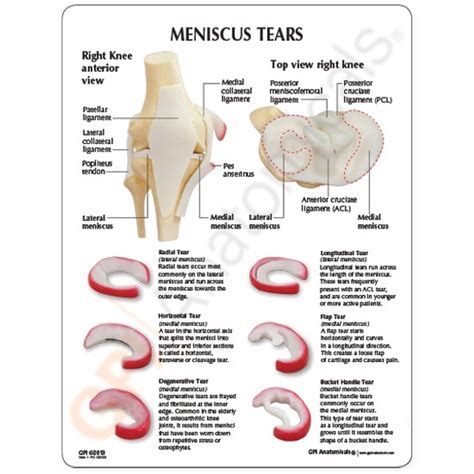 Knee Meniscus Diagram