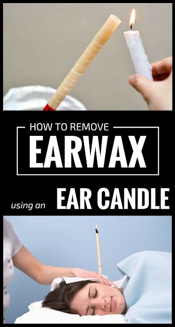 How To Remove Earwax Using An Ear Candle - Healthy Lifestyle