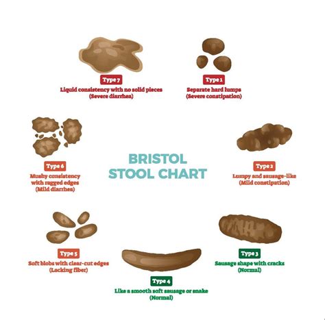 Bristol Stool Chart For Kids | Kids Matttroy