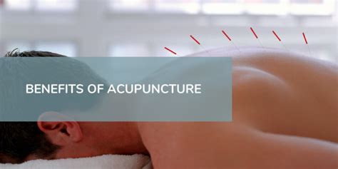 Benefits of Acupuncture • Life Therapies - Health and Wellness Centre ...