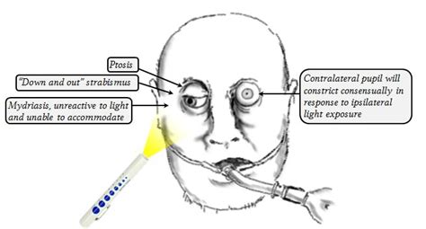 Pin by Miroslawa Bodnar on PA | Revision notes, Neurology, Physician assistant