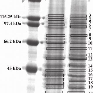 SDS-PAGE separation of cell lysis (molecular weight markers, A) from... | Download Scientific ...