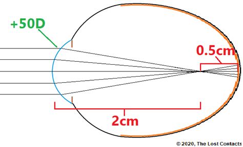 The Optics of Vision - Lesson 6: Emmetropia & Myopia - The Lost Contacts