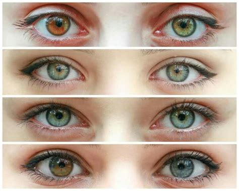 heterochromia | Heterochromia