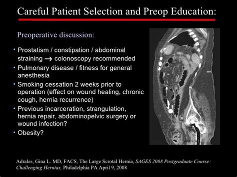 Management of Giant Scrotal Hernia