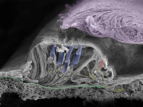 Incredible Synchrotron Imaging: New Findings in the Human Cochlea | Prof. Helge Rask-Andersen ...