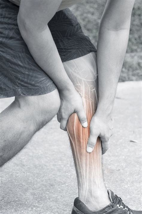 Leg muscle pain stock image. Image of pain, plantaris - 151671781