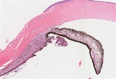 Iris Histology