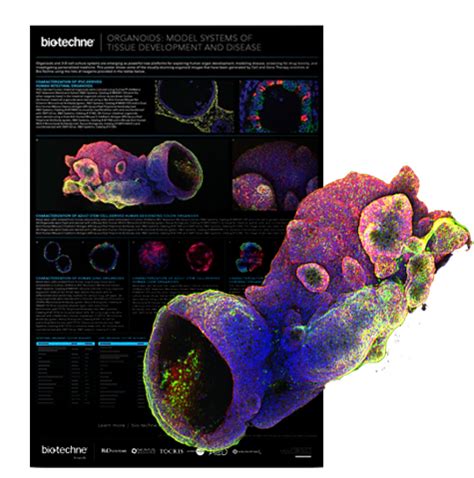 Organoids: Model Systems of Tissue Development and Disease Poster | Bio ...