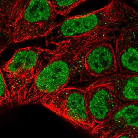 RNase1 Antibody (PA5-51519)