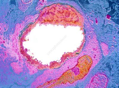 Capillary cross-section, TEM - Stock Image - C010/6043 - Science Photo Library