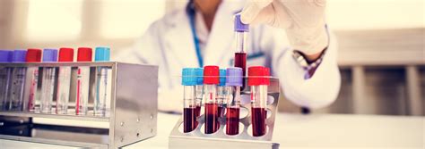 What Happens at a Blood Lab? - Healthcare Associates of Texas