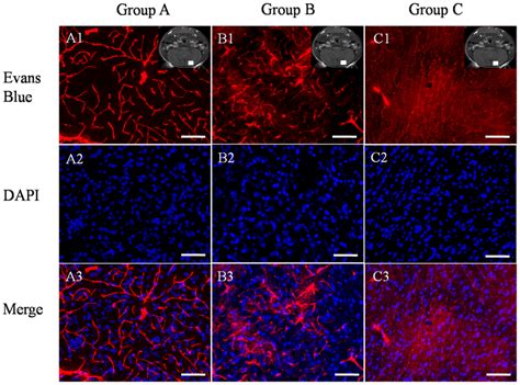 Permeability of blood vessels as revealed by Evans blue staining (2%, 3... | Download Scientific ...