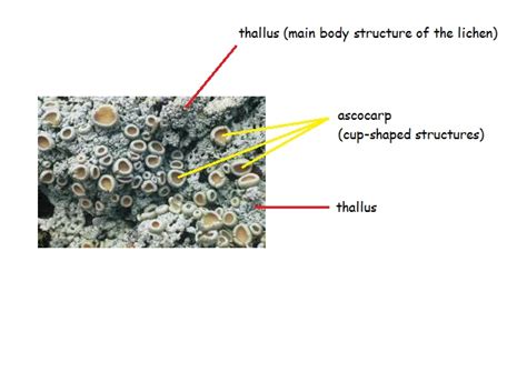 Foliose Lichen Under Microscope