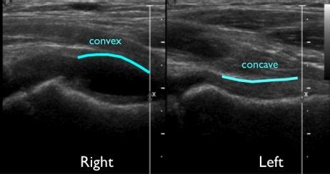 Pin on Sonography!