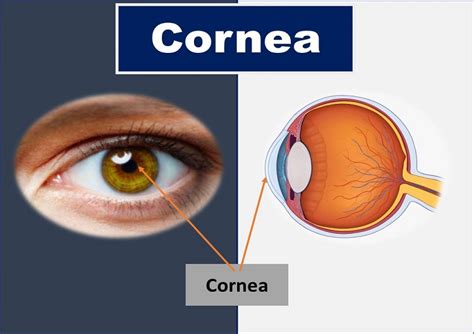 Cornea – Rotary Eye Hospital