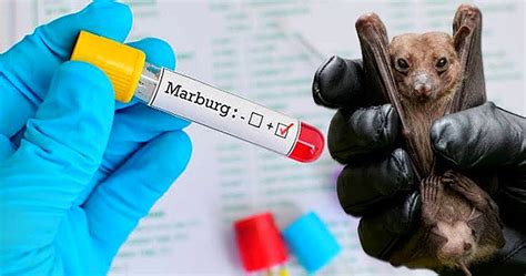 Tanzania Announces End Of Deadly Outbreak Of Marburg Virus - Heritage Times