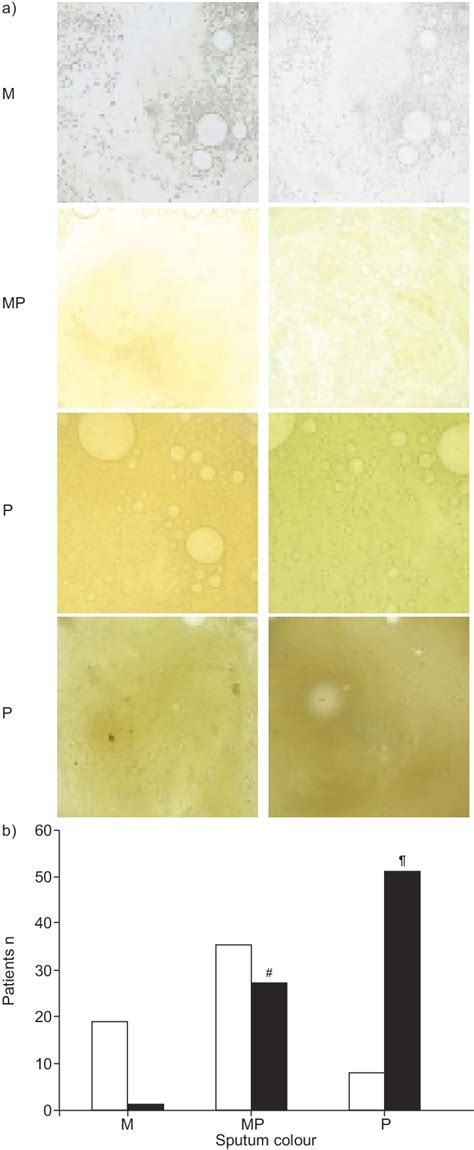 Nasal Mucus Color Chart