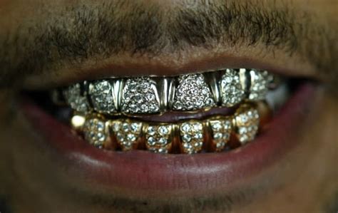 lil wayne teeth grillz | De Amor Imagenes