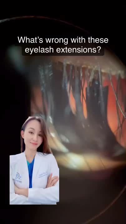 [Video] Dagny Zhu Luong, M.D. on LinkedIn: #lookatthelids #demodex #mites #eyelash #lashes # ...