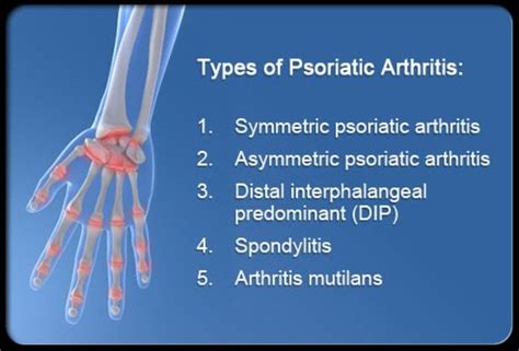 Symptoms, Causes, and Treatment of Psoriatic Arthritis | HealthProAdvice