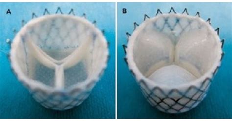 IDTechEx Research: Long Term In Vivo Performance of Tissue Engineered ...