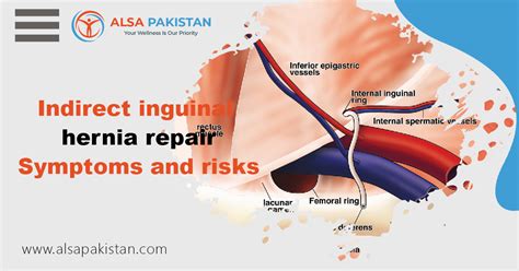 Indirect inguinal hernia repair | Symptoms and risks