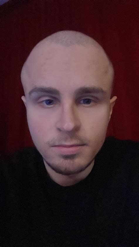 Weird head shape? 😅 : r/bald