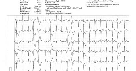 Electrocardiogram, abbreviated as either EKG or ECG, is used to record ...